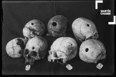 Cráneos trepanados con etiquetas numeradas de procedencia. En las etiquetas se inscriben las palabras: Incaraccay[sic], Choquebamba[sic]