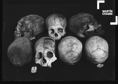 Cráneo trepanado con etiqueta numerada de procedencia. En la etiqueta se inscribe las palabra: Ccoñachuaylla Ollanta[sic], Incaraccay[sic]