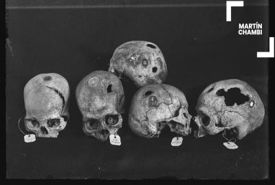 Cráneos trepanados con etiquetas numeradas de procedencia. En las etiquetas se inscriben las palabras: Yanapata, Choquepata Ollanta, Hiriyuyoc Occobamba[sic], Hiriypayoc[sic]