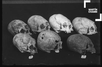 Cráneos trepanados con etiquetas numeradas de procedencia. En las etiquetas se inscriben las palabras: 49 Ccoñachuaylla Ollanta[sic], 25 Yanapata[sic], 2 Cantera Ollanta[sic]