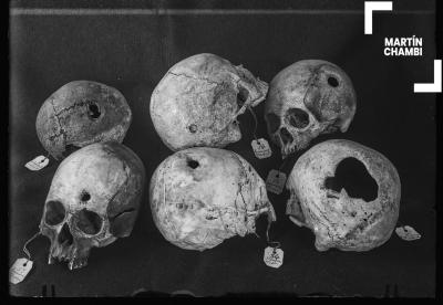 Cráneos trepanados con etiquetas numeradas de procedencia. En las etiquetas se inscriben las palabras: Hiriyuyoc Occobamba[sic], Choquepata Ollanta[sic], Incaraccay[sic]